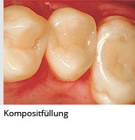 Konservierende ZHK, Parodontologie, Chirurgie